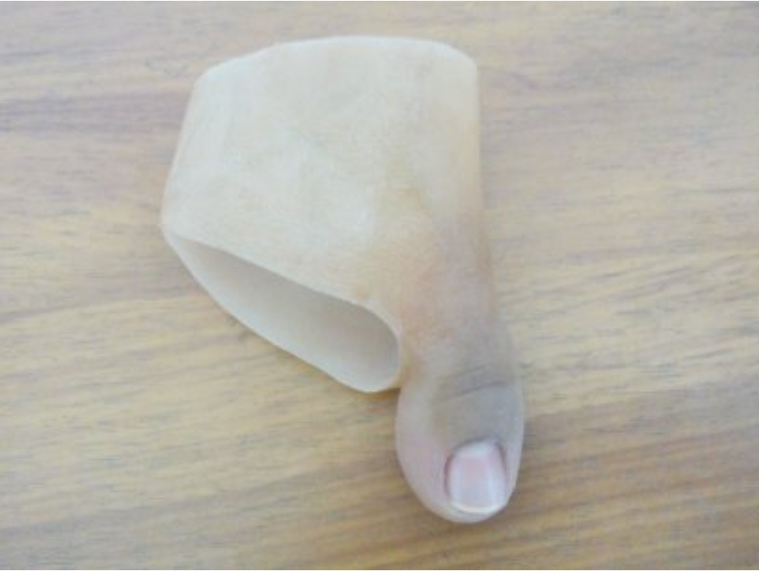 customised toe prosthesis